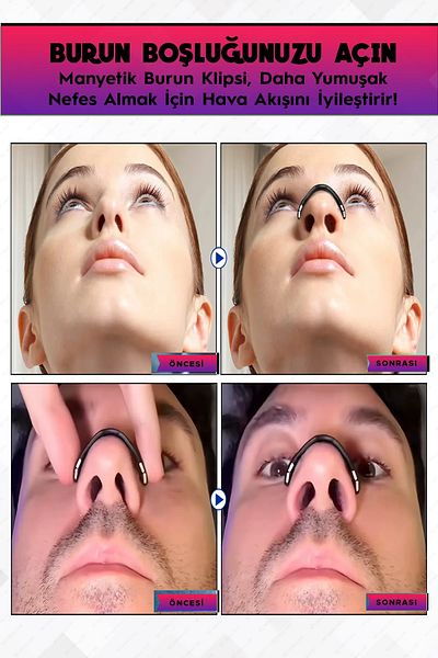 CEDAN Premium Magnetic Nasal Strip Set, 15-Piece White Anti-Snore Nasal Device