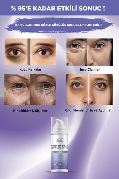 LAST TOUCH Under Eye Dark Circle, Puffiness, Wrinkle, Dark Circle and Brightening Eye Contour Cream 30 ml