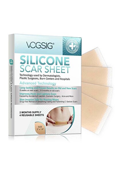 OEM Висококачествени медицински силиконови ленти за белези, 4 броя за многокр...