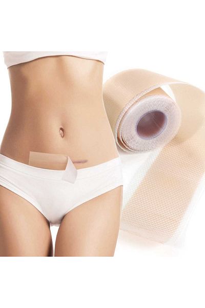 NOVA KISS Rolă din gel siliconic pentru tratarea cicatricilor, reutilizabilă, 4 cm x 3 m