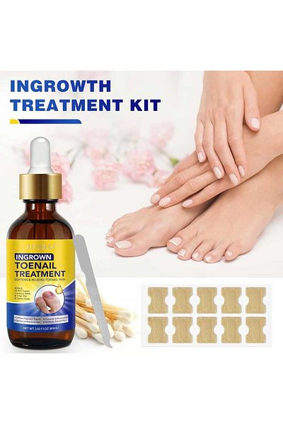 NOVA KISS Kit puternic de tratament pentru unghii încarnate și ciuperci de la picioare, previne inflamația, 60 ml