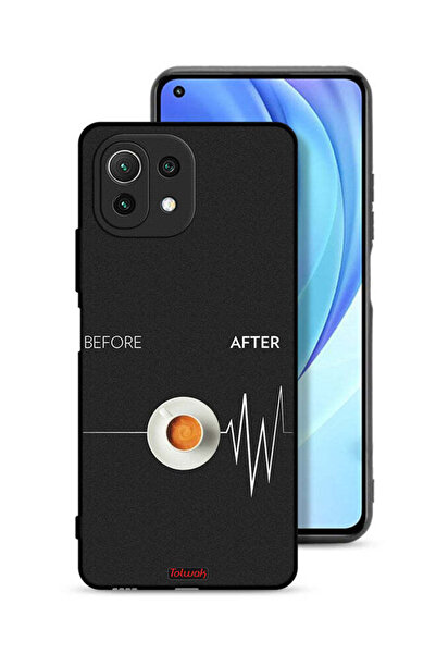 Tolwak غطاء حماية لهاتف Xiaomi Mi 11 Lite قبل وبعد