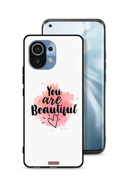 Tolwak Xiaomi Mi 11 Protective Case Cover You Are Beautiful