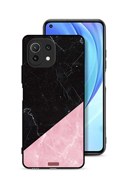 Tolwak غطاء حماية لهاتف شاومي مي 11 لايت بنمط رخامي