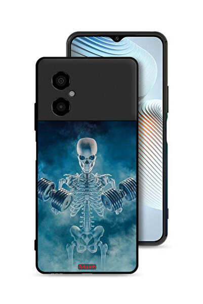 Tolwak غطاء حماية Xiaomi Poco M4 5G، وضعية "لا ألم ولا ربح"