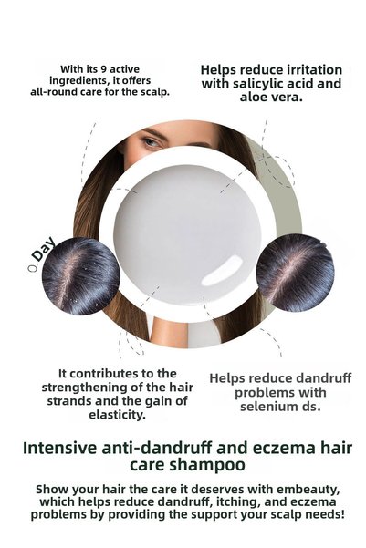 Embeauty Anti-Dandruff Itching and Eczema 9 Active Anti-Dandruff Salt-Free Shampoo 400 ml