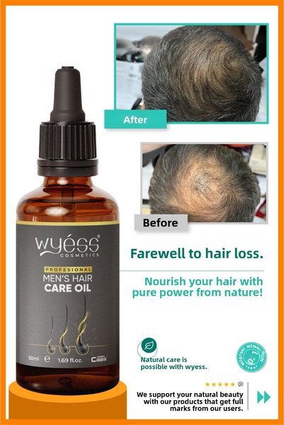 Wyess New Effective Formula Men's Hair Care Oil - Anti-Hair Loss, Hair Regrowth & Nourishing Effect, with Vitamins E & A, 50 ml