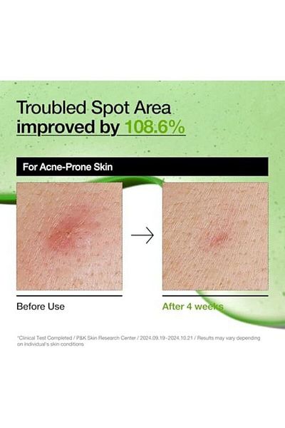 ANUA Pure Menthe Prebiotic Face Wash - For Combination