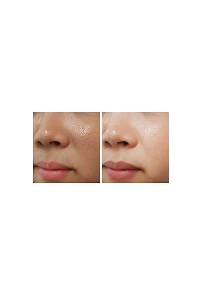 ACM ACM Depiwhite Advanced Cream - 40ml