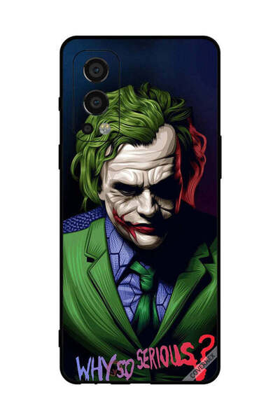 Covernex غطاء حماية لهاتف OnePlus Nord 2 5G لماذا هذا الجدية؟