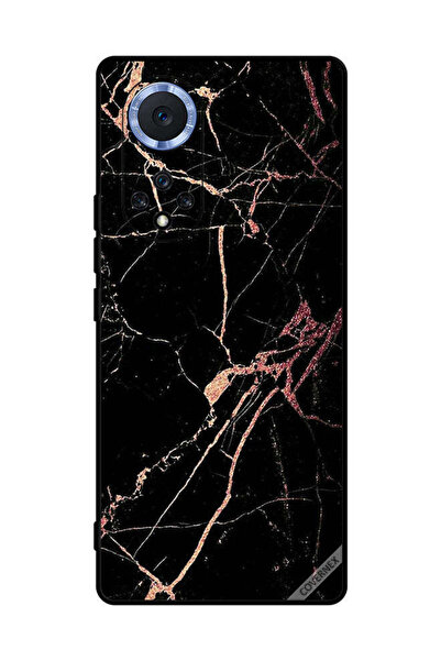 Covernex غطاء حماية لهاتف هواوي نوفا 9 برو بنمط رخامي أسود