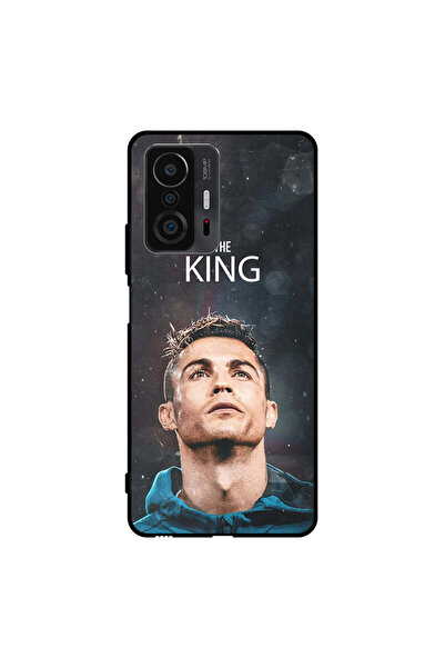 Covernex غطاء حماية لهاتف شاومي 11T رونالدو الملك