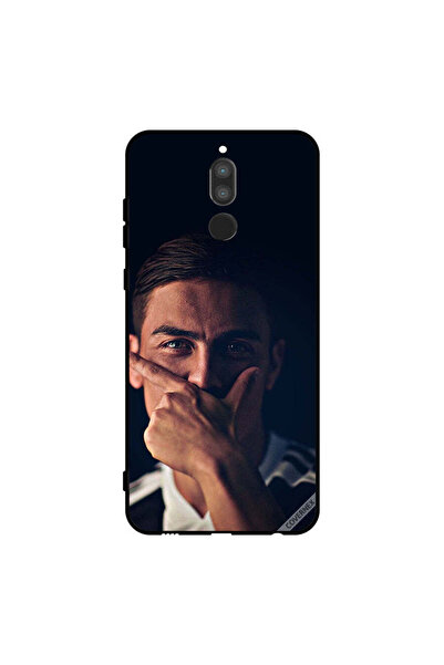 Covernex غطاء حماية لهاتف هواوي ميت 10 لايت - باولو دي جي