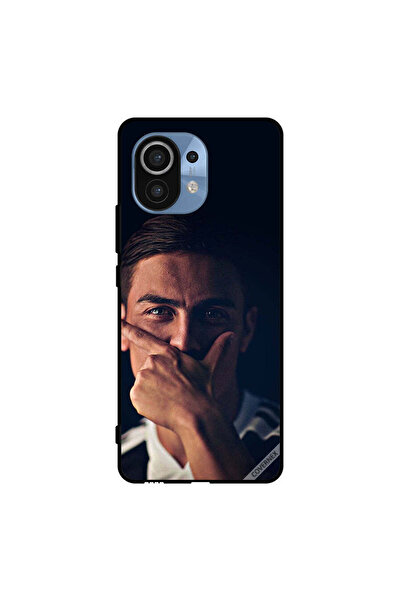 Covernex غطاء حماية لهاتف شاومي مي 11 باولو دي جي