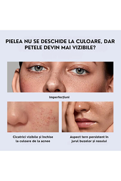 OEM LANBENA Facial Serum with Niacinamide 10%, Zinc and Hyaluronic Acid 15 ml