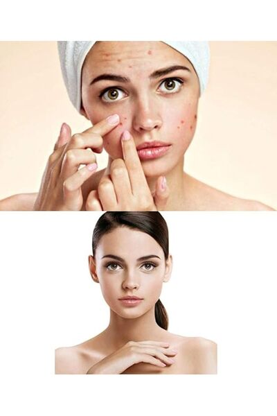 ACM Sébionex Trio Crème Apaisante Anti-Imperfections