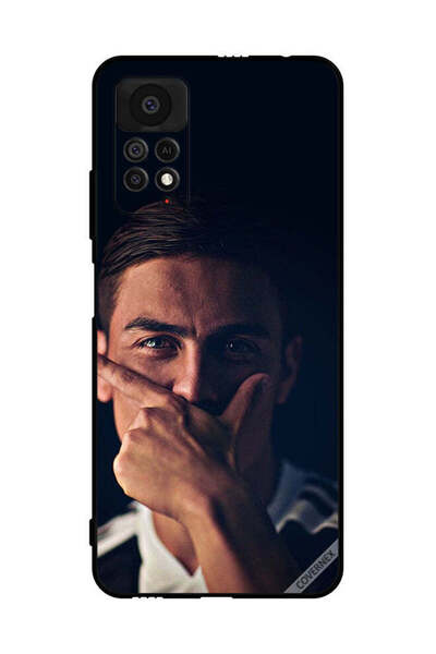 Covernex غطاء حماية لهاتف شاومي ريدمي نوت 11 برو 5G، باولو دي جي