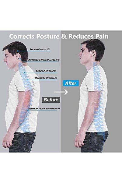 COOYA Back Brace, Posture Corrector for Women and Men, Back Support Straightener
