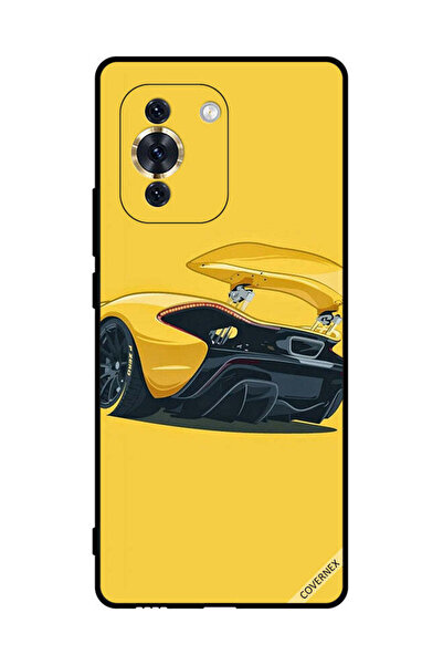 Covernex غطاء حماية لهاتف هواوي نوفا 10 بي زيرو