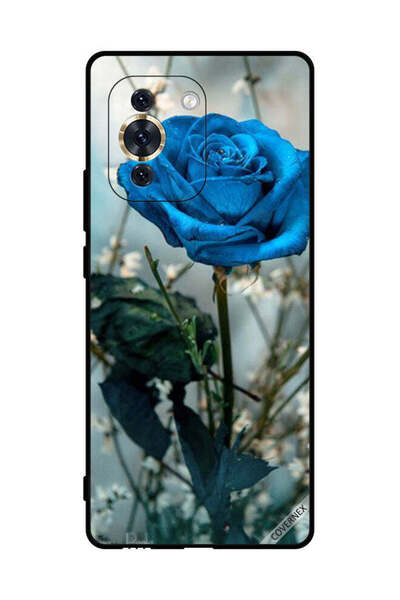 Covernex غطاء حماية لهاتف هواوي نوفا 10 برو - أزرق وردي