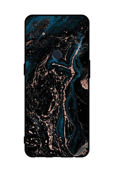 Covernex غطاء حماية لهاتف OnePlus Nord N10 5G بلون الرخام