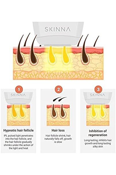 SHEWOW Skinna IPL Hair Removal System - Permanent Laser Hair Removal at Home for Face, Body, Bikini Line -