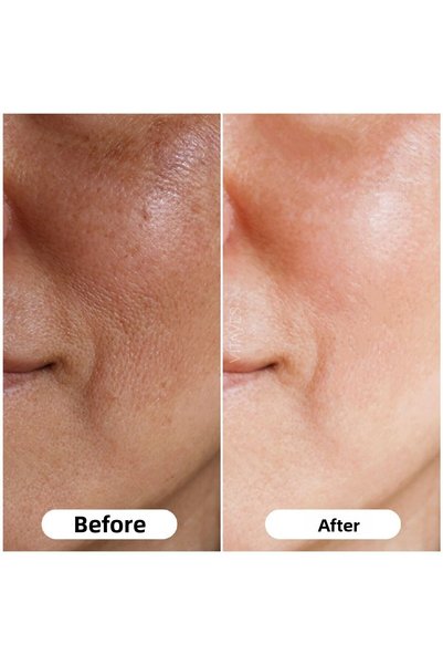 VITAYES Vitamin C 10% and Hyaluronic Acid Brightening Skin Tone Equalizing Skin Serum Dual Advantage Set