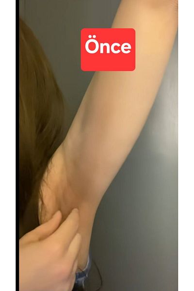 Kenta Whitening Kenta Cream Skin Face Underarm Bikini Area Elbow Whitening Private Area Darkening