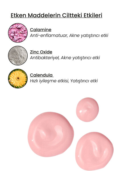 Luv it! Sivilce ve Akne Karşıtı Losyon 30ml – Salisilik Asit Içeren Kurutucu