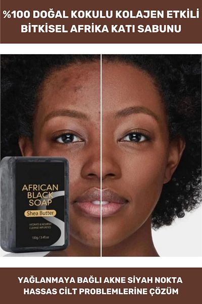 Thriftbuds 100% Natural Body Hand Face Hair Beautiful Fragrant Skin Repairing Collagen Effective African Herbal Soap 1Pcs
