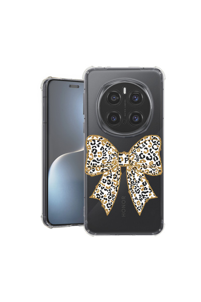 bestcase ® Carcasă antișoc pentru Honor Magic7 Pro, model leopard, 1926356 AS...