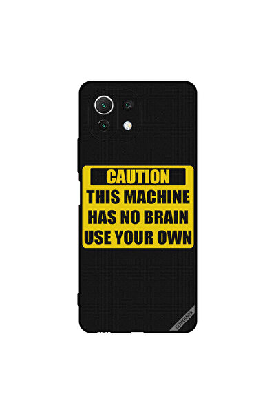 Covernex غطاء حماية لهاتف Xiaomi Mi 11 Lite تحذير: هذا الجهاز ليس له عقل