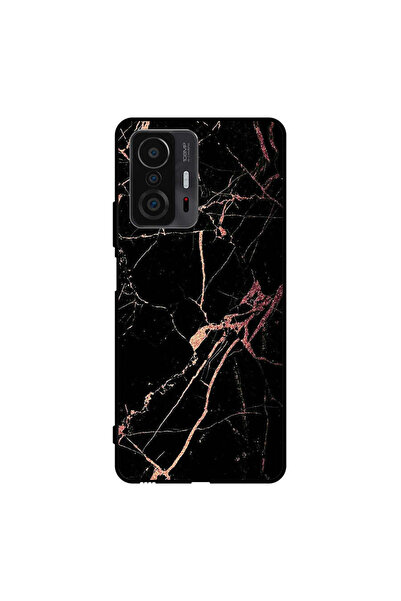 Covernex غطاء حماية لهاتف Xiaomi 11T بنمط رخامي أسود