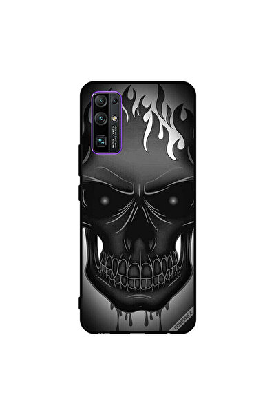 Covernex غطاء حماية لهاتف Honor 30 l Art