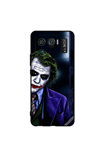 Covernex غطاء حماية لهاتف شاومي مي 11 ألترا بمظهر عاطفي