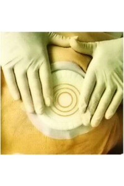 Coloplast (5 قطع) 33353 غطاء جروح هيدروكولويد داخلي للضغط من كومفيل بلس 10 سم