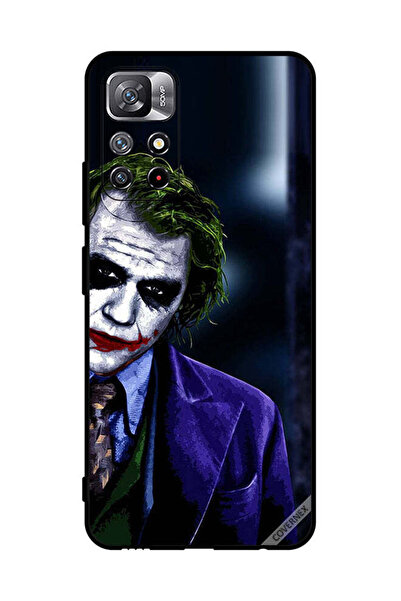 Covernex غطاء حماية لهاتف شاومي ريدمي نوت 11S 5G - نظرة عاطفية