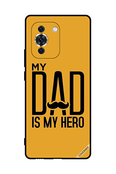 Covernex غطاء حماية لهاتف هواوي نوفا 10 برو - والدي هو بطلي