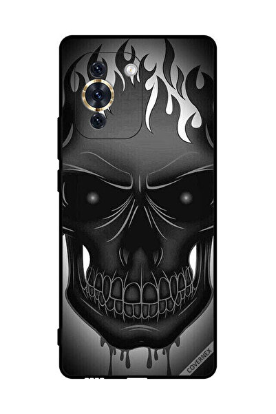 Covernex غطاء حماية لهاتف هواوي نوفا 10 برو - رسمة جمجمة