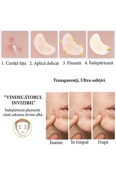 NOVA KISS Plasturi hidrocoloizi anti-acnee, set de 20 de bucăți, transparenți, ultra-subțiri, formulă premium