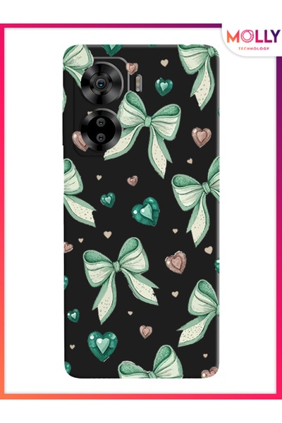 Molly Casper Via X40 İçin Siyah Aqua Ribbons Desenli Silikon Kılıf