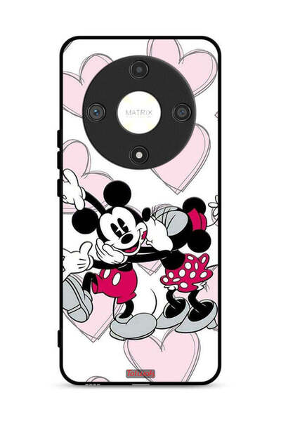 Tolwak غطاء حماية لهاتف Honor X9b 5G بتصميم عناق ميكي ماوس