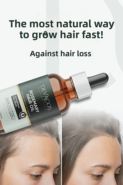DEVACOS Rosemary Oil Complex Fast Hair and Beard Growth Biotin Oil for Hair Loss and Damaged Hair