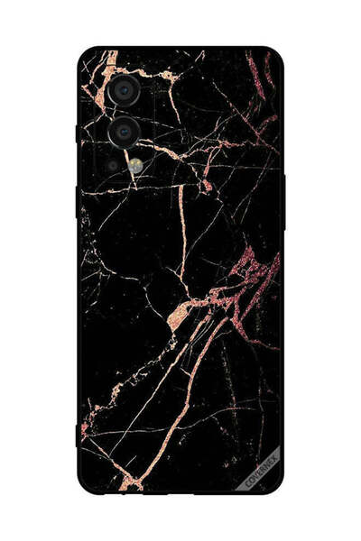 Covernex غطاء حماية لهاتف OnePlus Nord 2 5G بنمط رخامي أسود