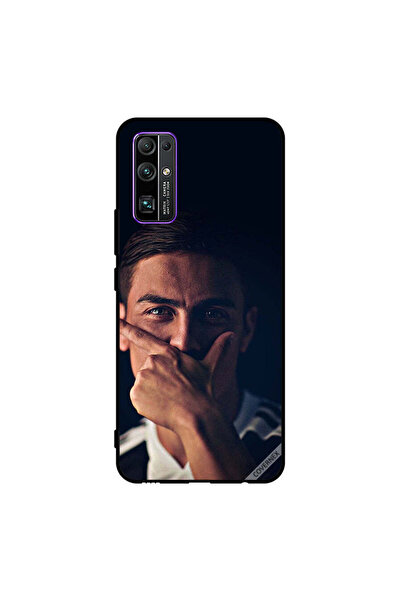 Covernex غطاء حماية لهاتف Honor 30 من باولو دي جي