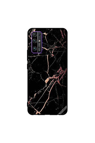 Covernex غطاء حماية لهاتف Honor 30 بنمط رخامي أسود