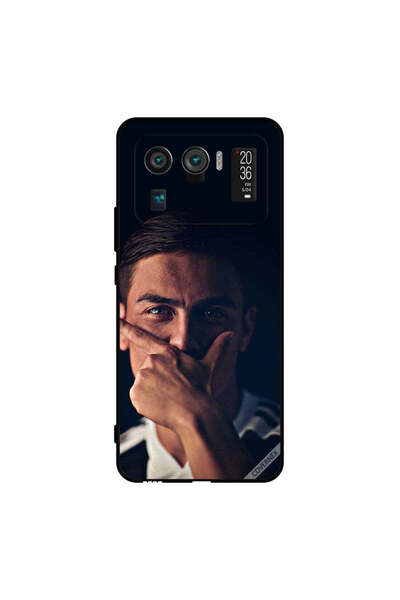 Covernex غطاء حماية لهاتف شاومي مي 11 ألترا باولو دي جي