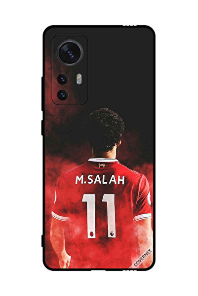 Covernex غطاء حماية لهاتف شاومي 12 نجمة مصرية بألوان متعددة