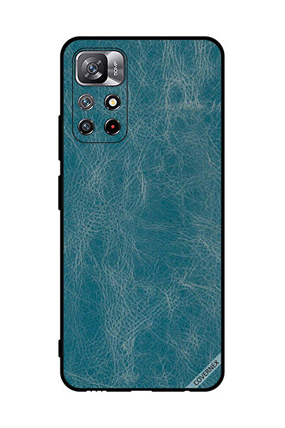 Covernex غطاء حماية لهاتف شاومي ريدمي نوت 11S 5G بنمط جلدي أزرق