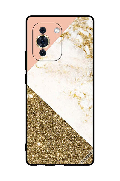 Covernex غطاء حماية لهاتف هواوي نوفا 10 بنقشة لامعة ورخامية